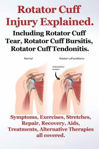 rotator cuff