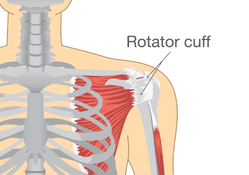Rotator Cuff chiropractor